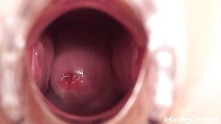 Young nurse gapes her pussy and shows her cervix through the speculum